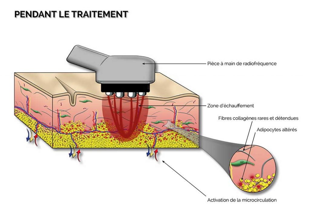 EXPLICATIONS