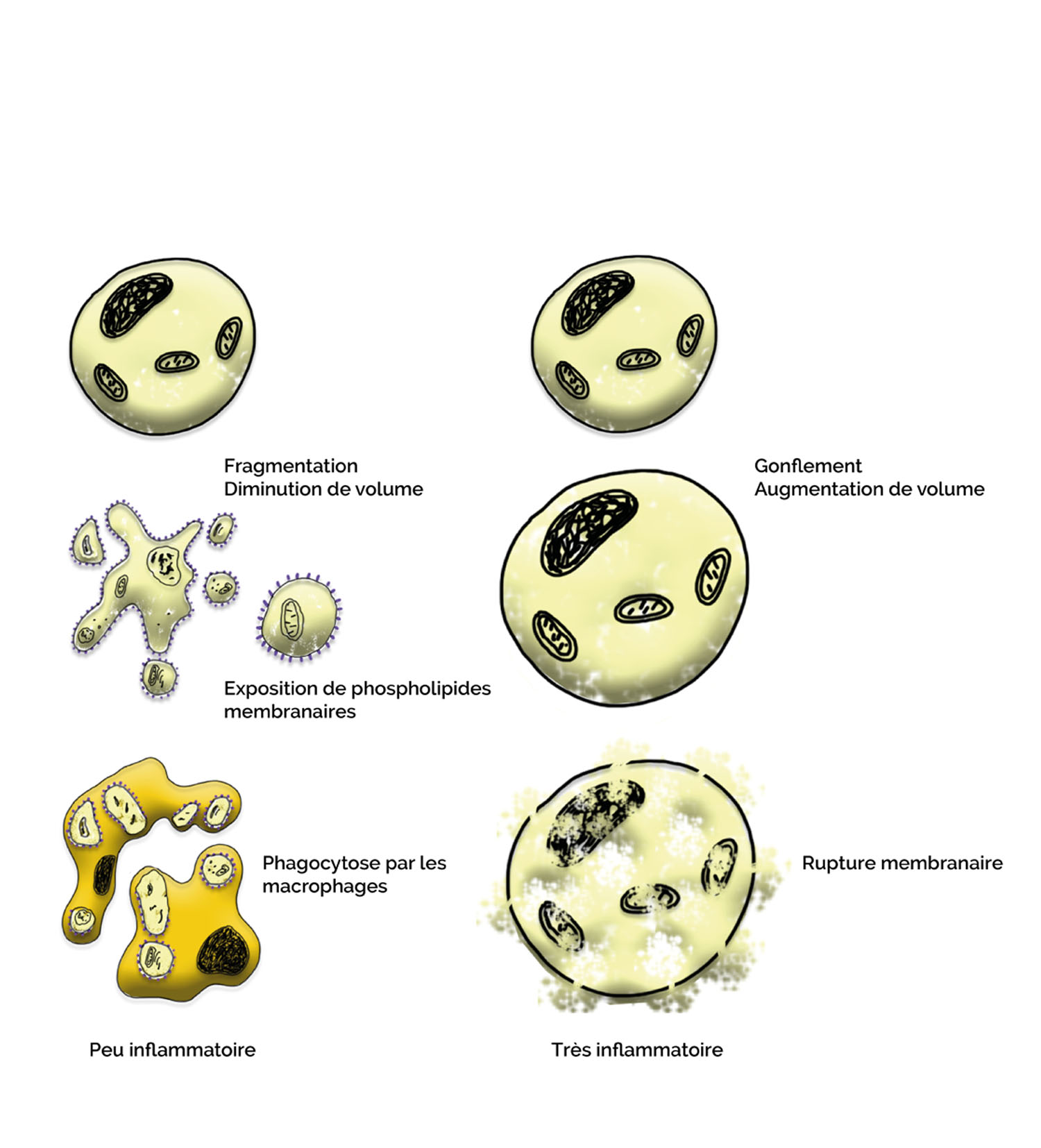 necrose et apotpose lors de la cryolipolyse