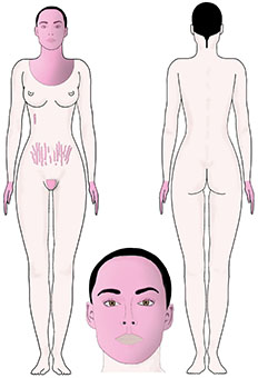 mesolift