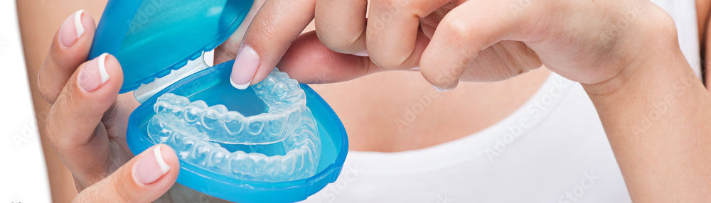 orthodontie par aligneurs