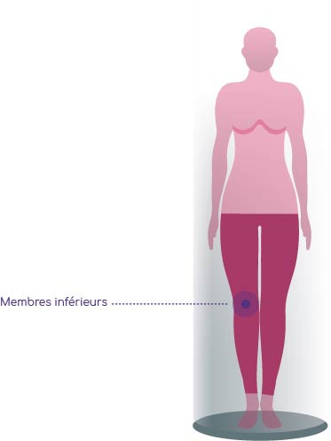 VARICOSITES DES MEMBRES INFERIEURS - Zones de traitement